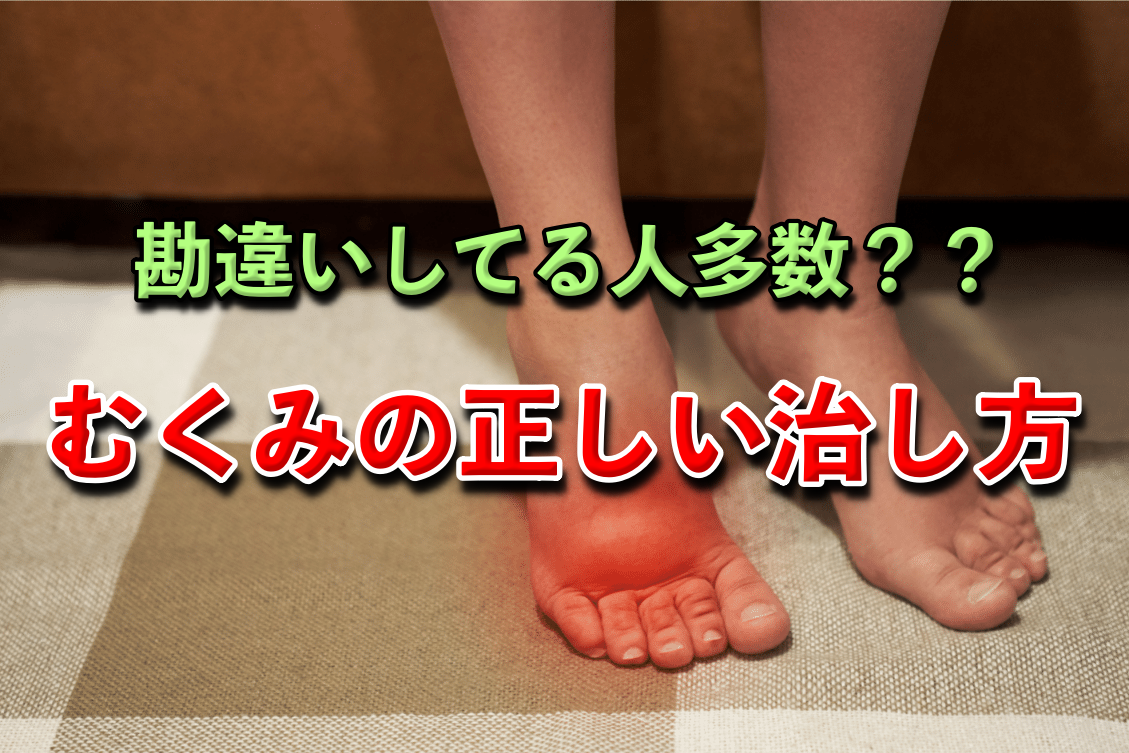 意外と勘違いしている人が多い?むくみを治す正しい解消法